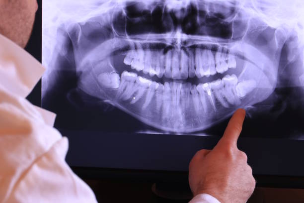 Best Emergency Wisdom Tooth Extraction in Jones, OK